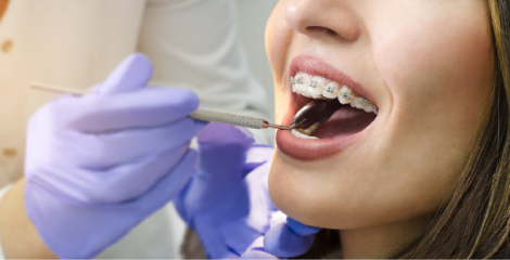 矯正歯科のご案内｜治療の流れ・費用・使用装置など｜協同歯科